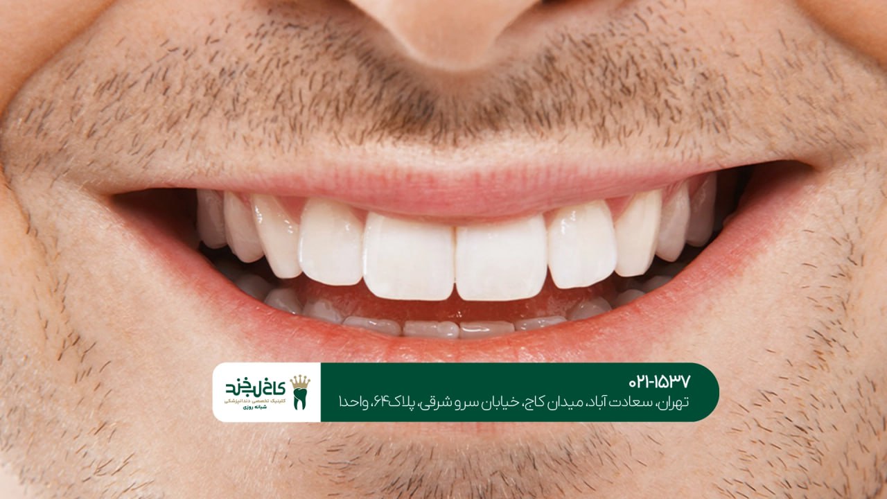 دندانپزشکی زیبایی و تخصصی در تهران دندانپزشکی زیبایی و تخصصی در تهران