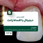 کاشت دندان دیجیتال با اقساط راحت