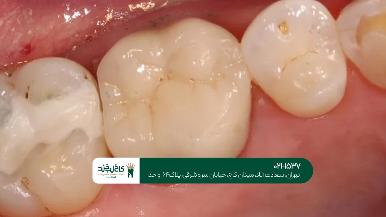 مرکز ترمیم دندان اقساطی شمال تهران مرکز ترمیم دندان اقساطی شمال تهران