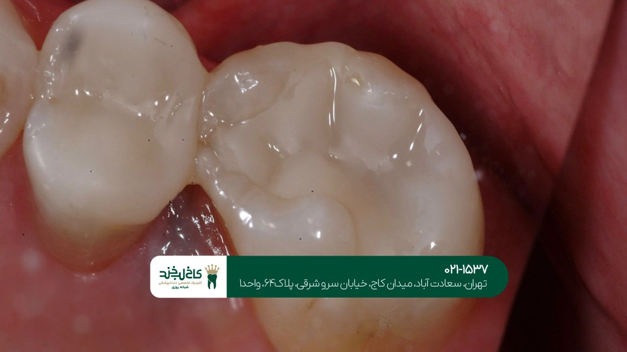 مرکز ترمیم دندان اقساطی شمال تهران مرکز ترمیم دندان اقساطی شمال تهران