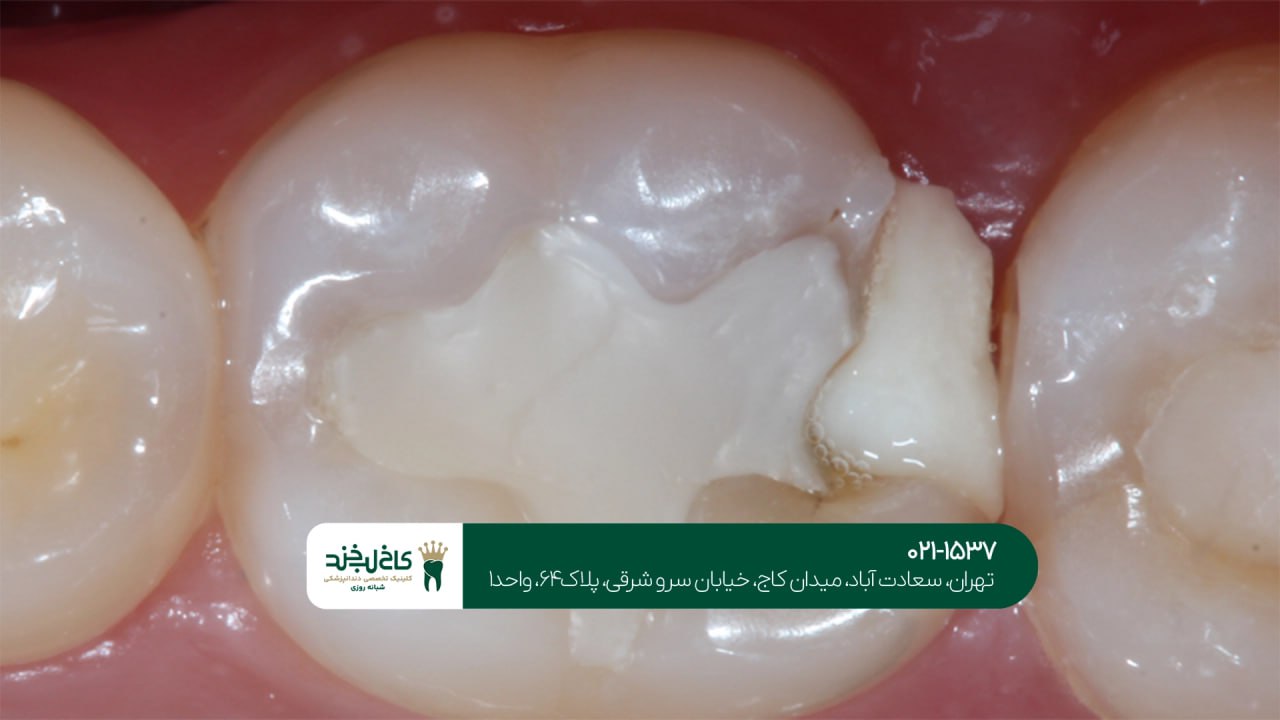 مرکز ترمیم دندان اقساطی شمال تهران مرکز ترمیم دندان اقساطی شمال تهران