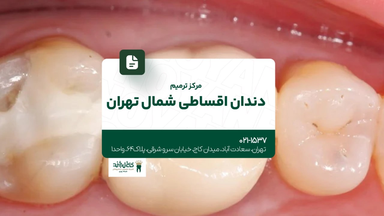 مرکز ترمیم دندان اقساطی شمال تهران مرکز ترمیم دندان اقساطی شمال تهران