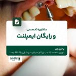مشاوره تخصصی و رایگان ایمپلنت