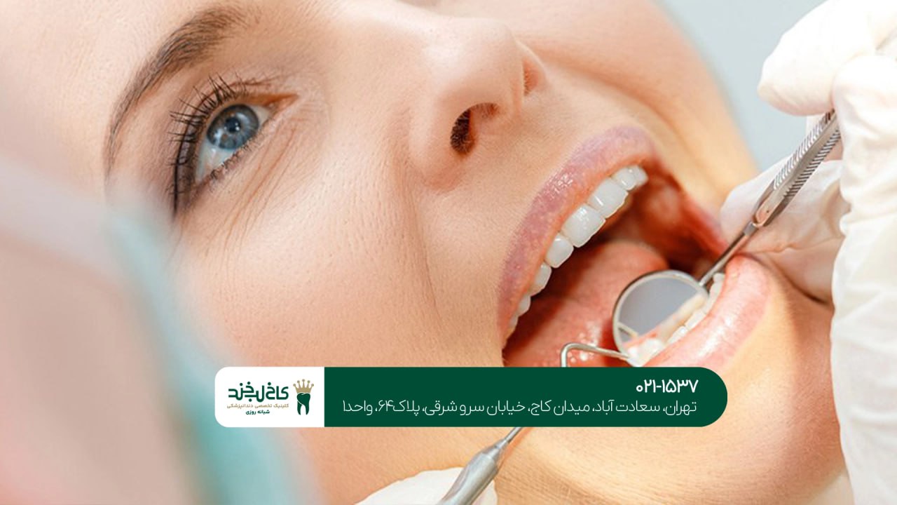بهترین دندانپزشکی زیبایی اقساطی بهترین دندانپزشکی زیبایی اقساطی