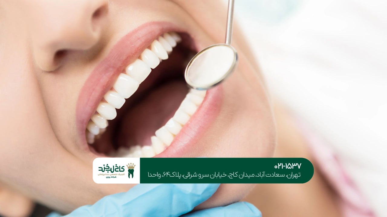 بهترین دندانپزشکی زیبایی اقساطی بهترین دندانپزشکی زیبایی اقساطی