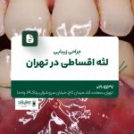 جراحی زیبایی لثه اقساطی در تهران