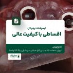 ایمپلنت دیجیتال اقساطی با کیفیت عالی