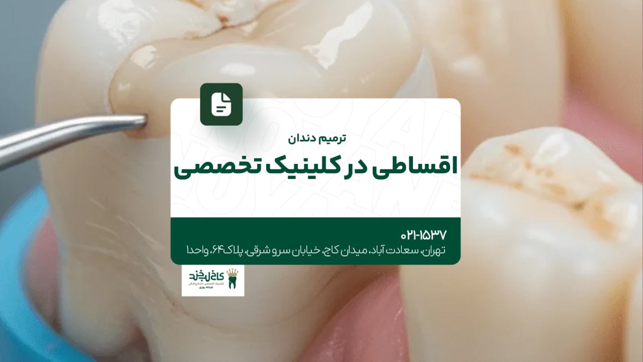ترمیم دندان اقساطی در کلینیک تخصصی ترمیم دندان اقساطی در کلینیک تخصصی