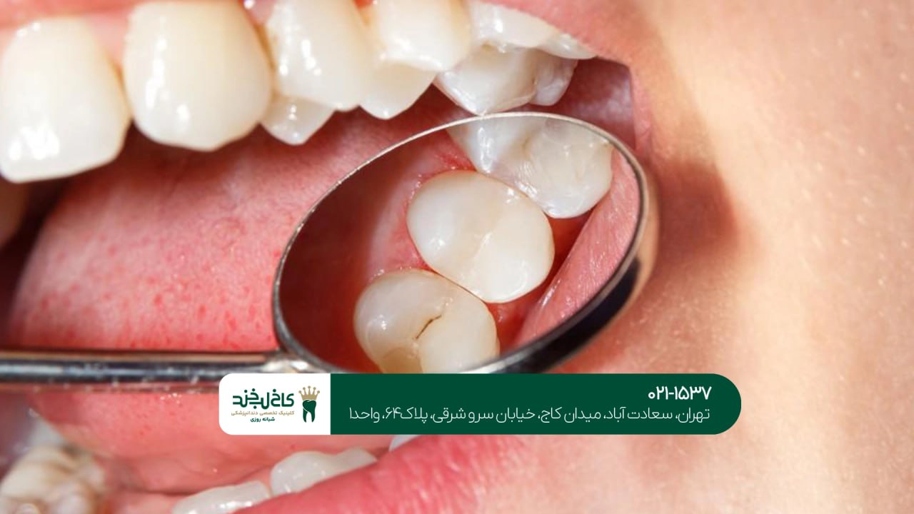 ترمیم دندان اقساطی در کلینیک تخصصی ترمیم دندان اقساطی در کلینیک تخصصی