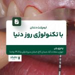 ایمپلنت دندان با تکنولوژی روز دنیا