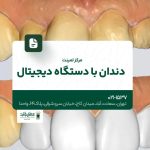 مرکز لمینت دندان با دستگاه دیجیتال