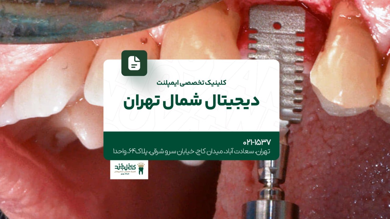 کلینیک تخصصی ایمپلنت دیجیتال شمال تهران کلینیک تخصصی ایمپلنت دیجیتال شمال تهران