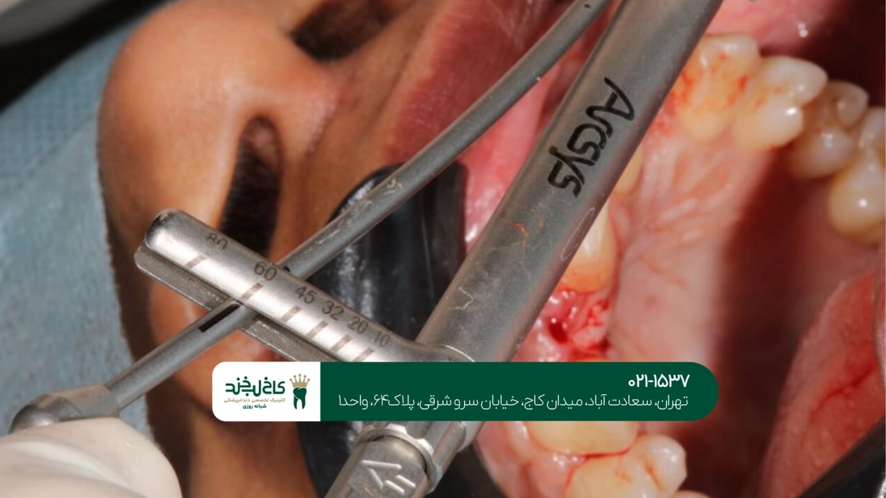 کلینیک تخصصی ایمپلنت دیجیتال شمال تهران کلینیک تخصصی ایمپلنت دیجیتال شمال تهران