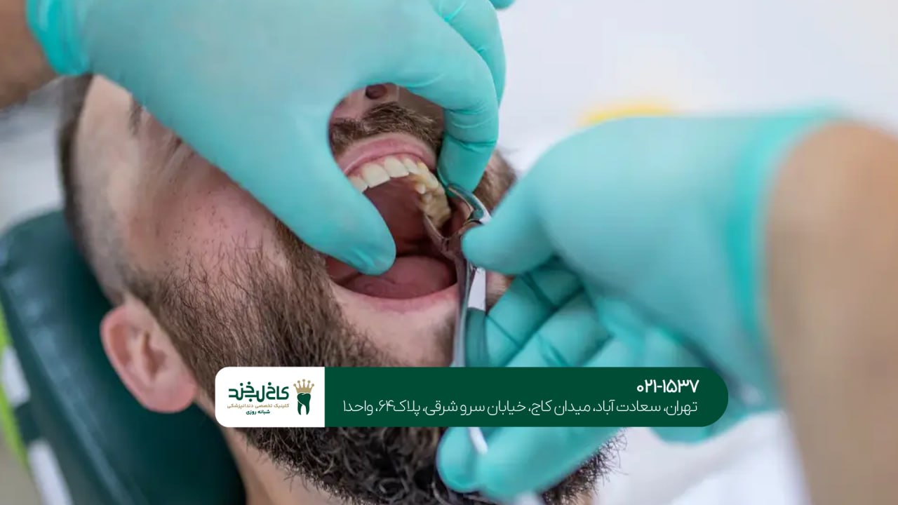مشاوره آنلاین دندانپزشکی اقساطی مشاوره آنلاین دندانپزشکی اقساطی