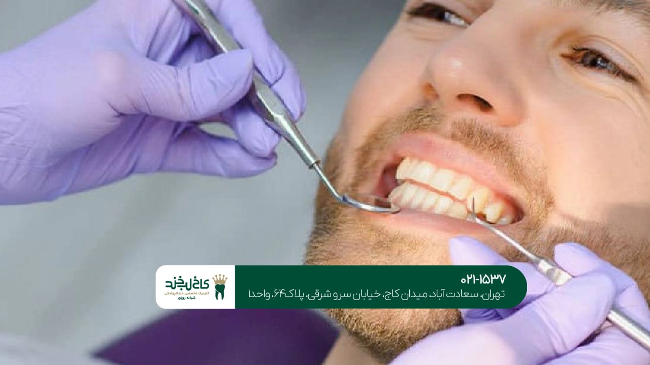 مشاوره آنلاین دندانپزشکی اقساطی مشاوره آنلاین دندانپزشکی اقساطی