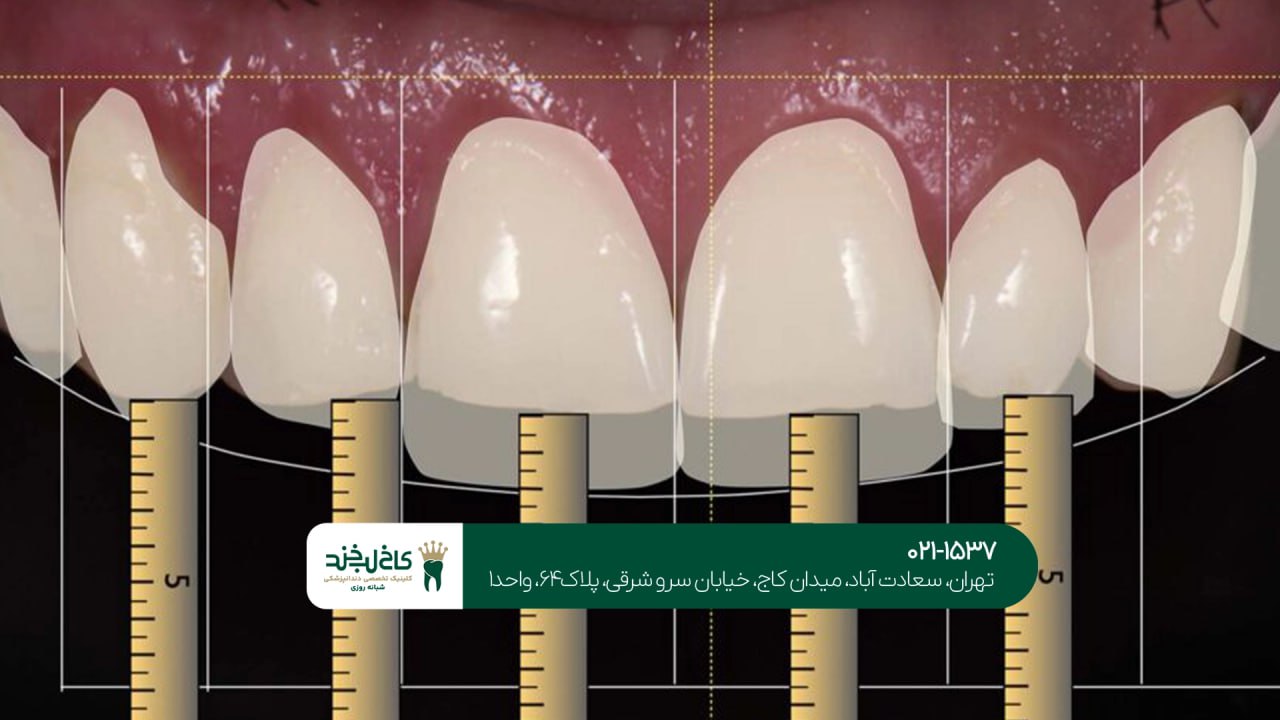اصلاح طرح لبخند با فناوری دیجیتال اصلاح طرح لبخند با فناوری دیجیتال