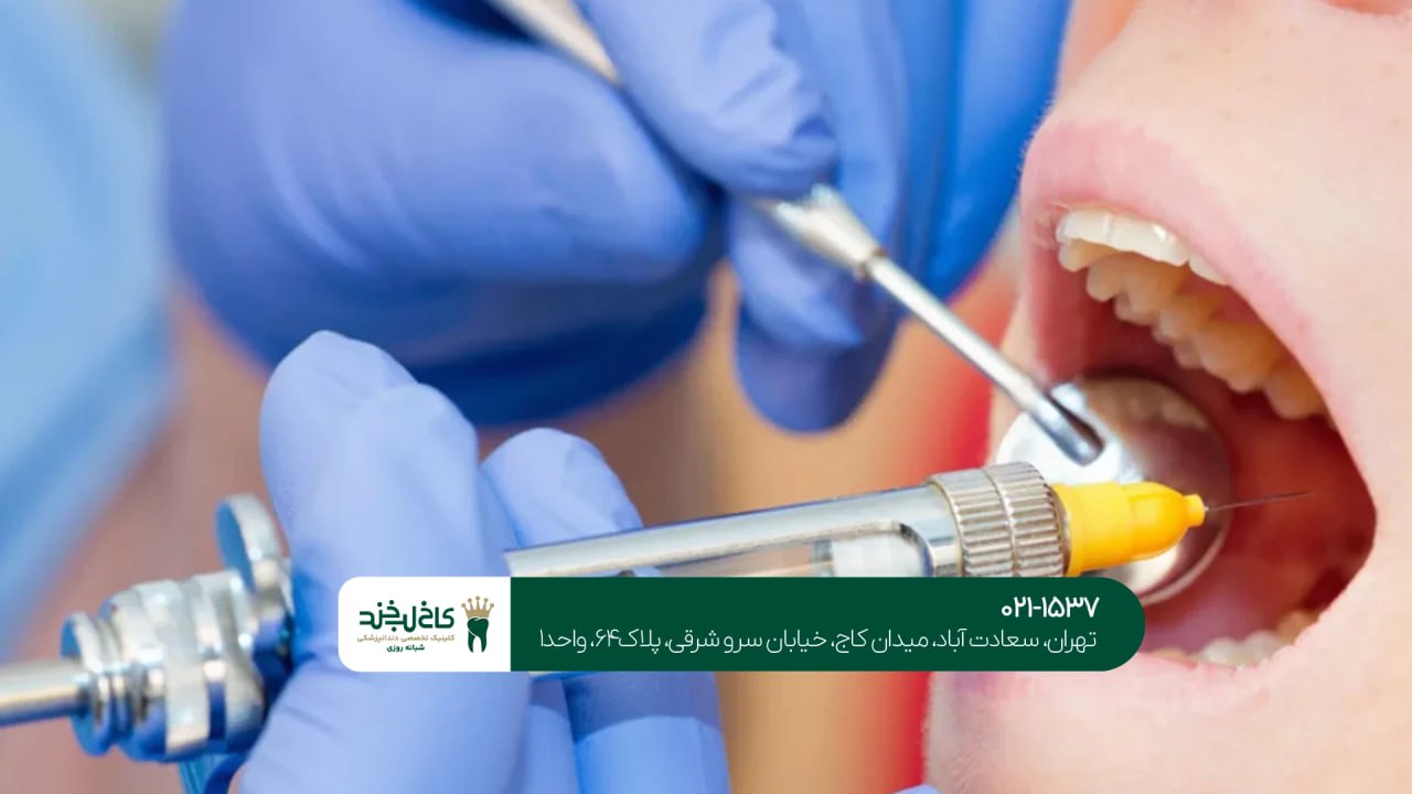 بهترین روش بی حسی برای جراحی دندان بهترین روش بی حسی برای جراحی دندان