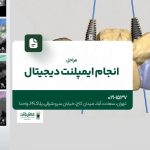 مراحل انجام ایمپلنت دیجیتال