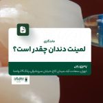 ماندگاری لمینت دندان چقدر است؟