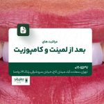مراقبت های بعد از لمینت و کامپوزیت