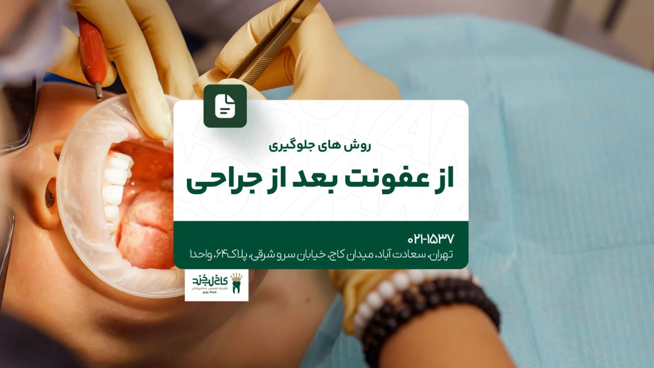 روش های جلوگیری از عفونت بعد از جراحی روش های جلوگیری از عفونت بعد از جراحی