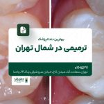 بهترین دندانپزشک ترمیمی در شمال تهران