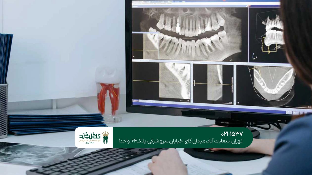 ایمپلنت دیجیتال با دستگاه اسکن داخل دهانی ایمپلنت دیجیتال با دستگاه اسکن داخل دهانی