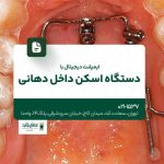 ایمپلنت دیجیتال با دستگاه اسکن داخل دهانی