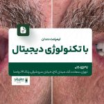 ایمپلنت دندان با تکنولوژی دیجیتال