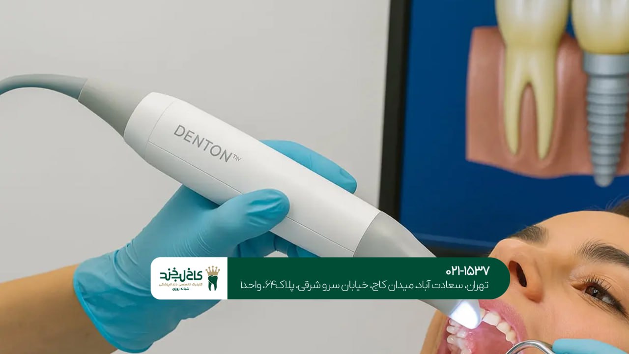 کاشت دندان با اسکن سه بعدی فک کاشت دندان با اسکن سه بعدی فک