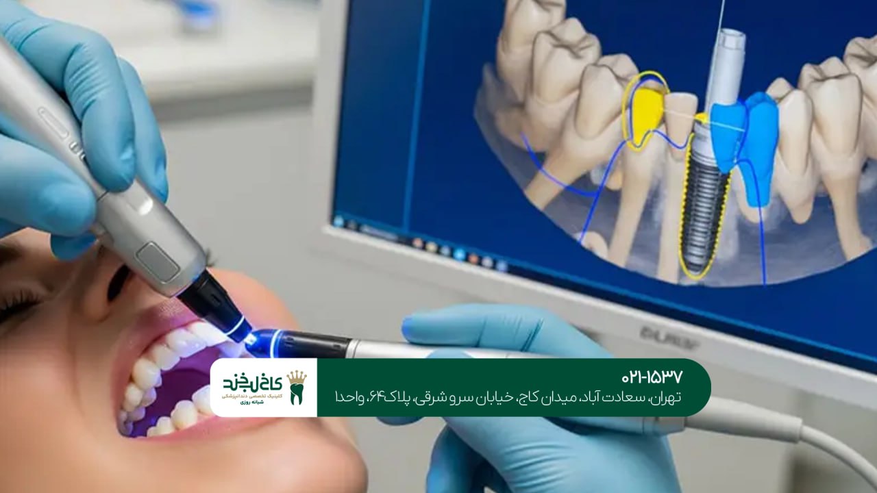 کاشت دندان با اسکن سه بعدی فک کاشت دندان با اسکن سه بعدی فک