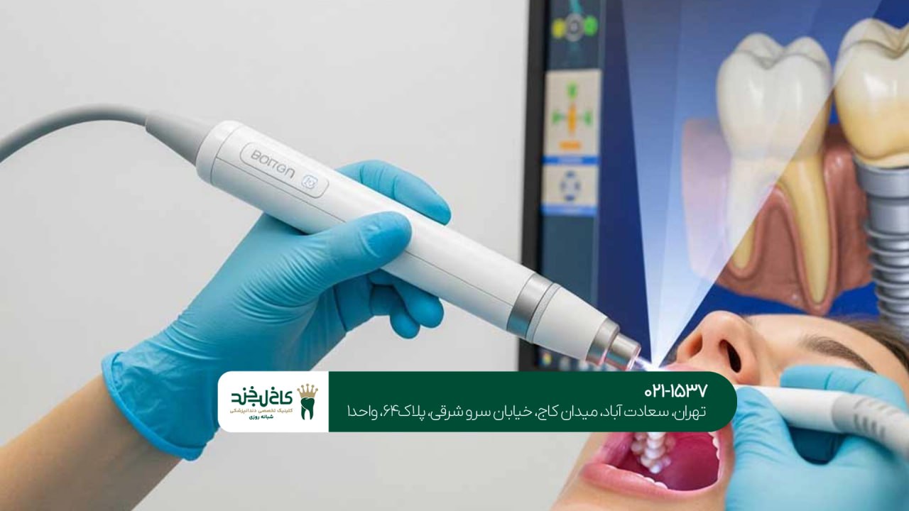کاشت دندان با اسکن سه بعدی فک کاشت دندان با اسکن سه بعدی فک