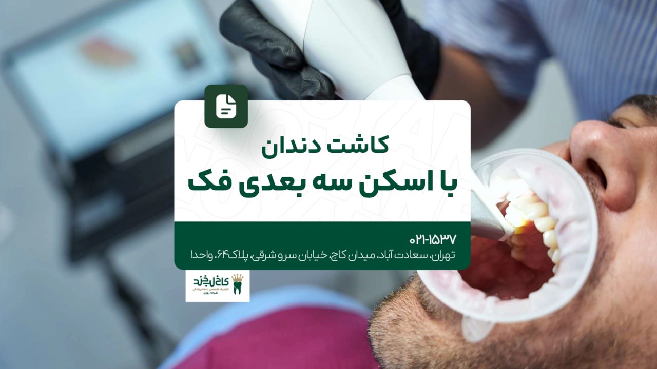کاشت دندان با اسکن سه بعدی فک کاشت دندان با اسکن سه بعدی فک