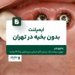 ایمپلنت بدون بخیه در تهران