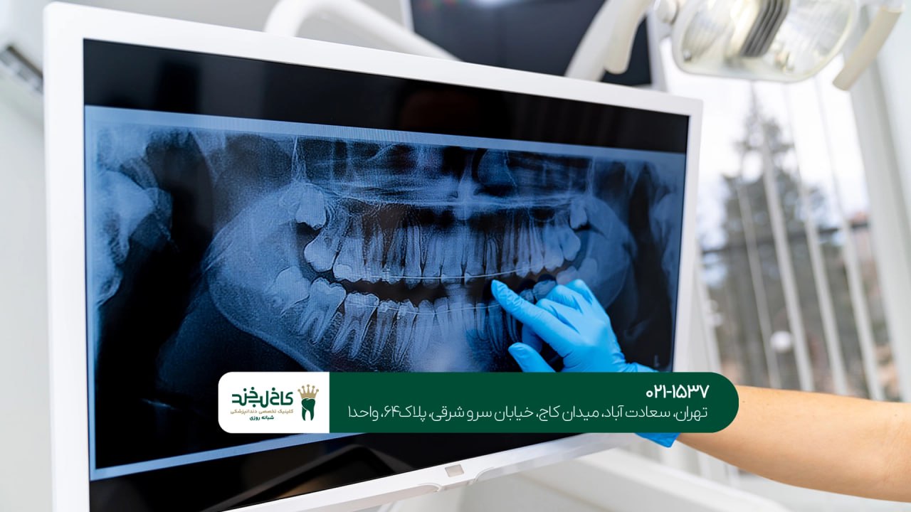 دندانپزشکی مجهز به رادیوگرافی دیجیتال دندانپزشکی مجهز به رادیوگرافی دیجیتال
