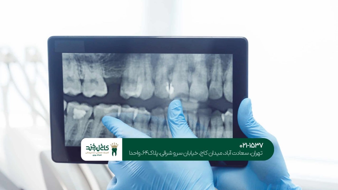 دندانپزشکی مجهز به رادیوگرافی دیجیتال دندانپزشکی مجهز به رادیوگرافی دیجیتال