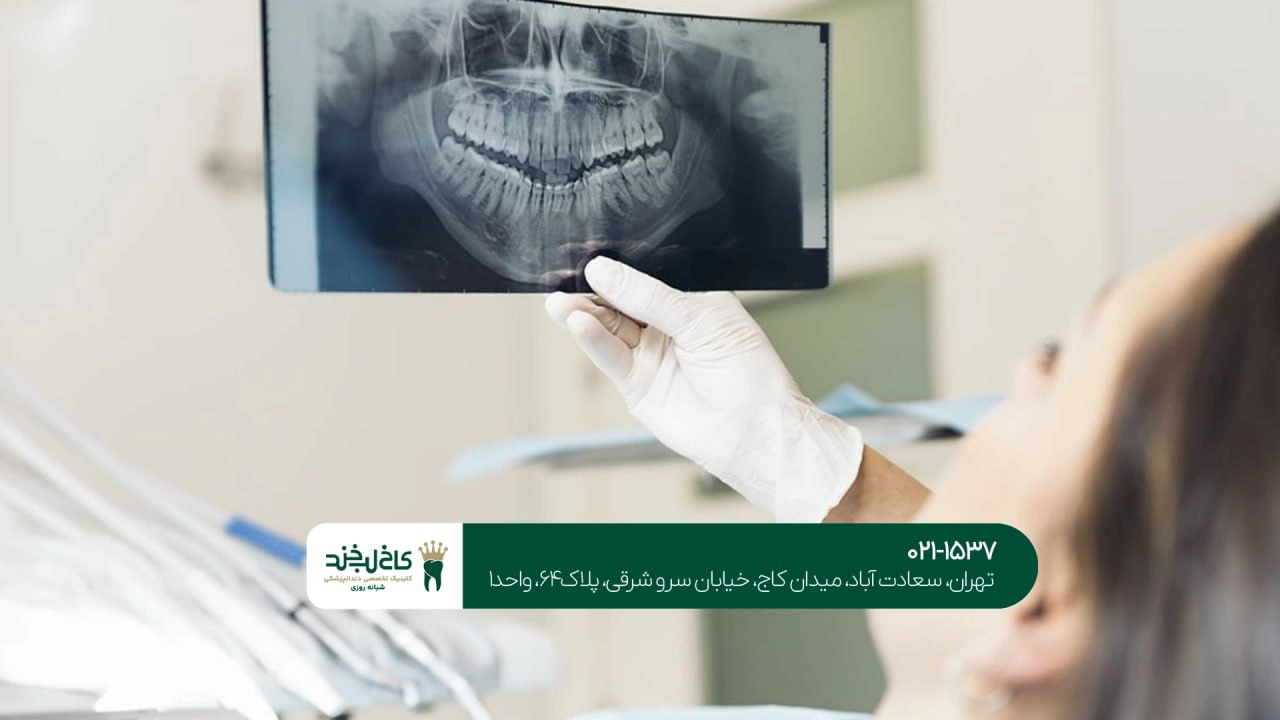 دندانپزشکی مجهز به رادیوگرافی دیجیتال دندانپزشکی مجهز به رادیوگرافی دیجیتال