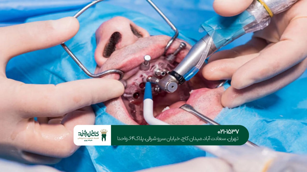 دندانپزشکی تخصصی فک و صورت در تهران دندانپزشکی تخصصی فک و صورت در تهران