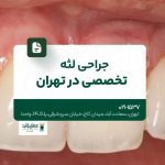 جراحی لثه تخصصی در تهران