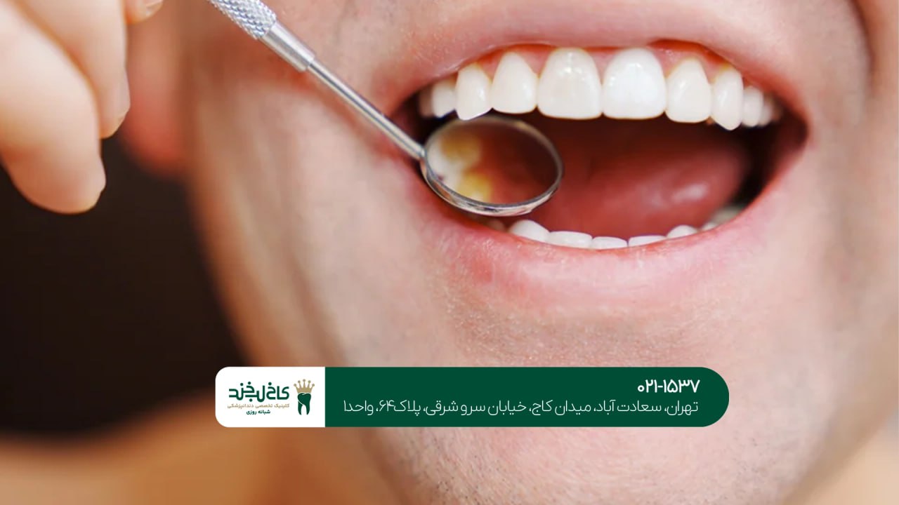 بهترین دندانپزشکی شبانه روزی در ایران بهترین دندانپزشکی شبانه روزی در ایران