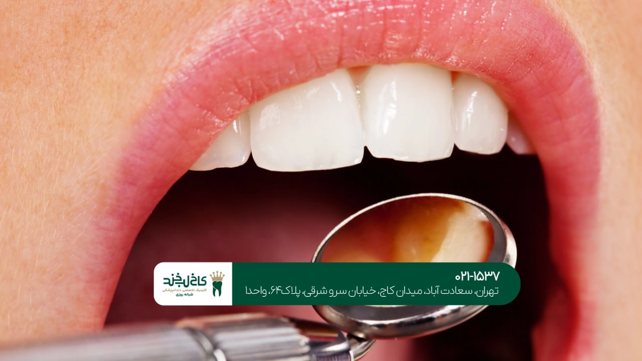 بهترین دندانپزشکی شبانه روزی در ایران بهترین دندانپزشکی شبانه روزی در ایران