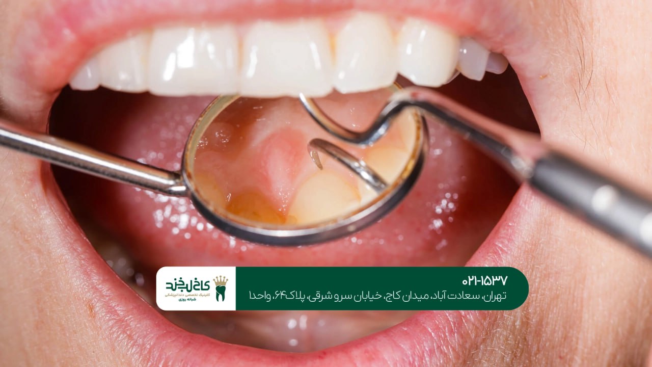 تخصصی ترین مرکز درمان دندان تخصصی ترین مرکز درمان دندان