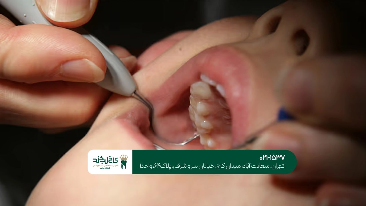 بهترین دندانپزشک درمان دندان بهترین دندانپزشک درمان دندان