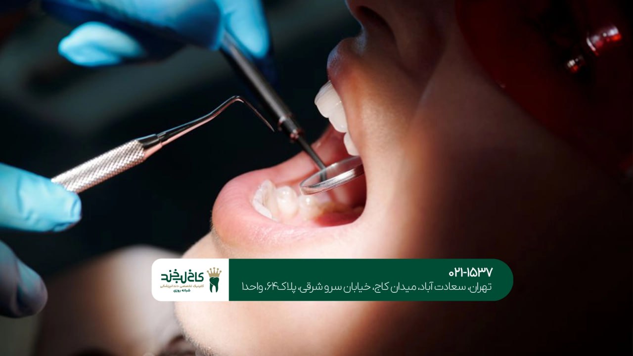 بهترین دندانپزشک درمان دندان بهترین دندانپزشک درمان دندان