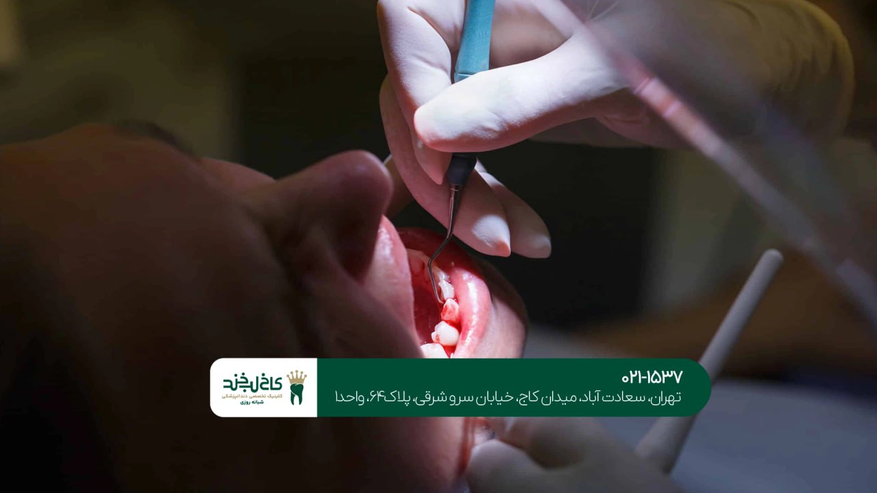 جراحی دندان به صورت تخصصی جراحی دندان به صورت تخصصی