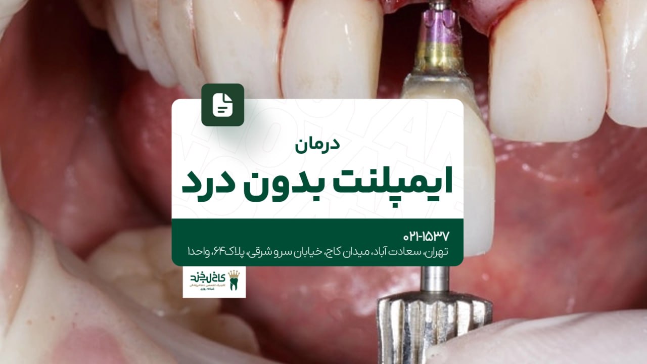 درمان ایمپلنت بدون درد درمان ایمپلنت بدون درد