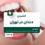 کشیدن دندان در تهران