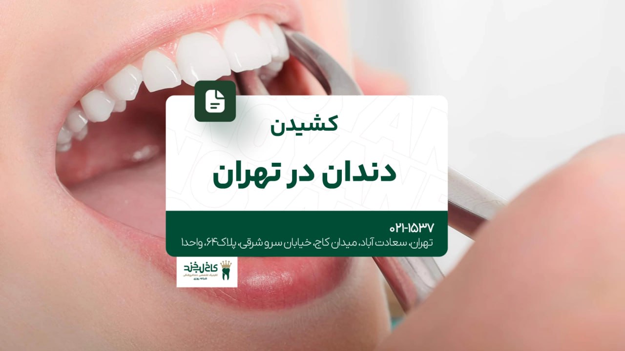 کشیدن دندان در تهران کشیدن دندان در تهران