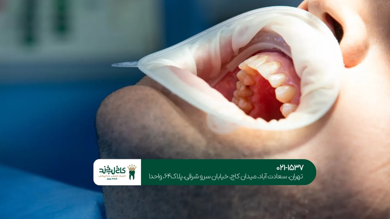 بهترین کلینیک کامپوزیت دندان