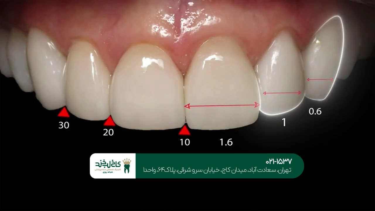 بهترین دندانپزشک طرح لبخند تهران